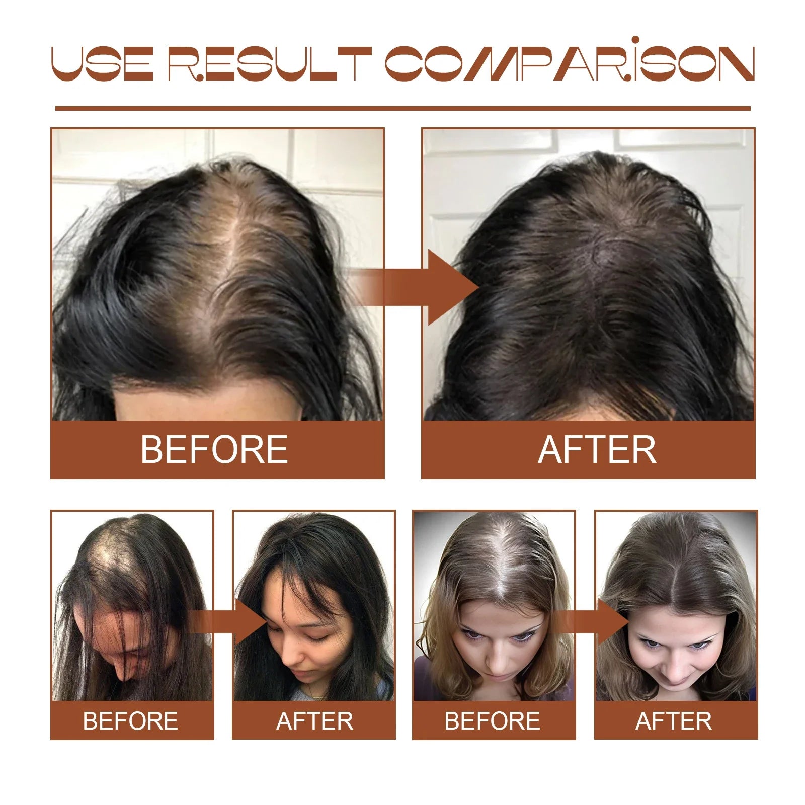 100% Pure Organic Hair Mask Batana Oil