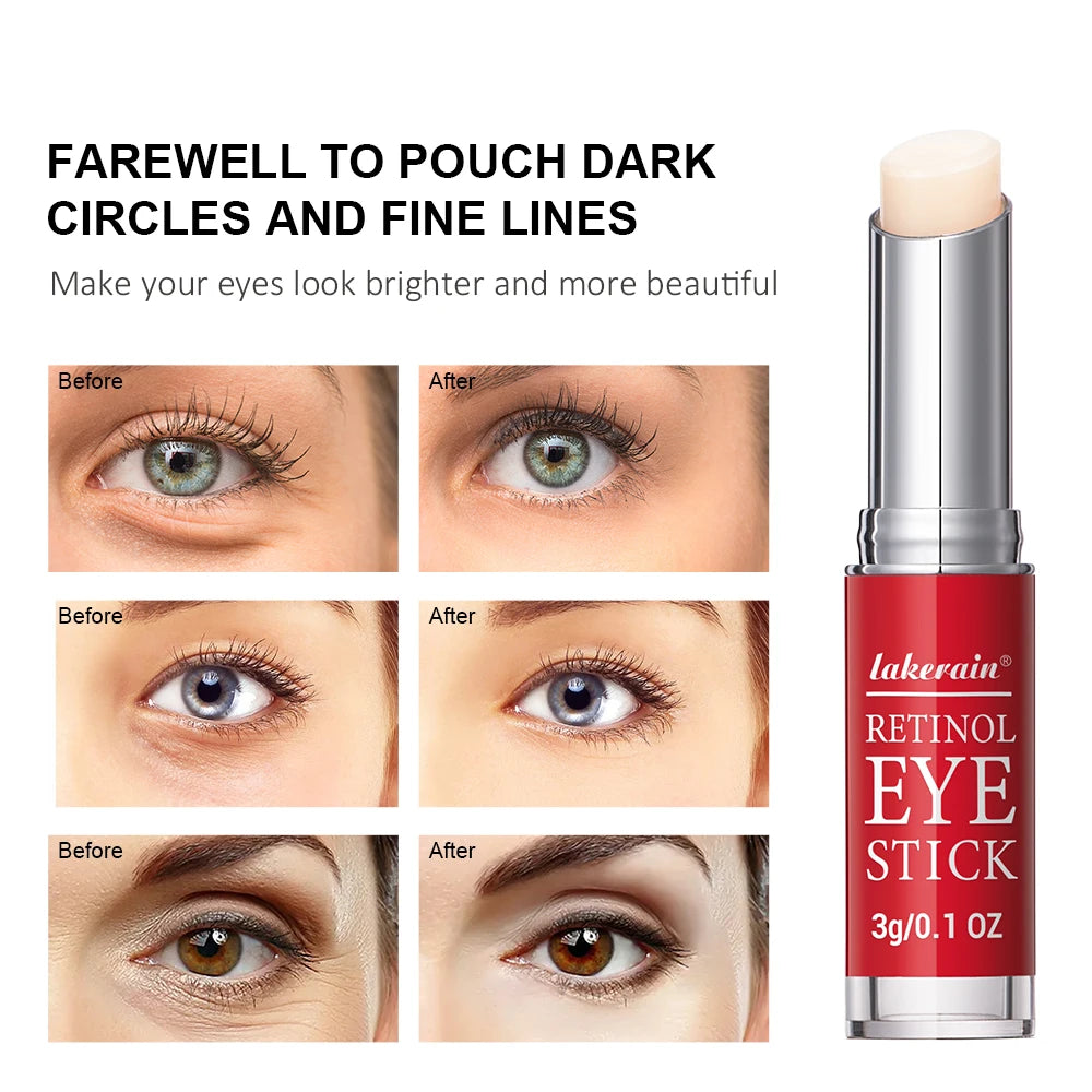 Retinol Eye Cream Lightening Dark Circles Firming Skin Instant Eye Repair Serum