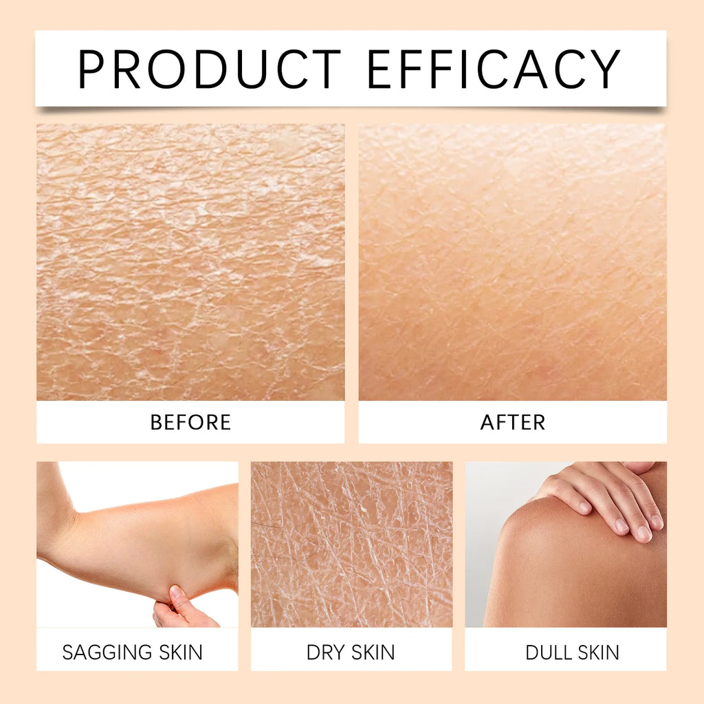 Honey Cream Fade Dark Spots Remove